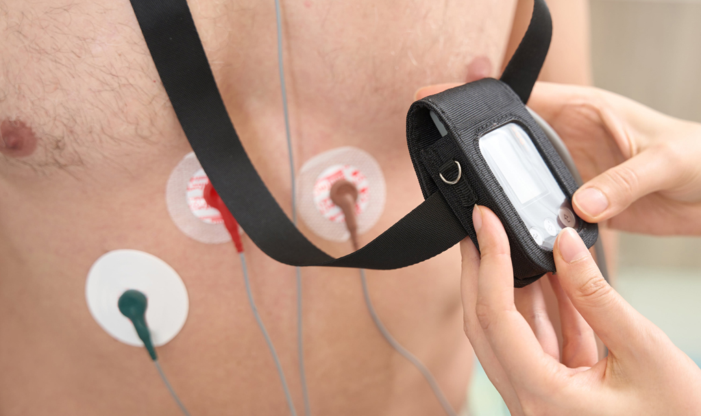 24-Hour Holter Monitoring 2
