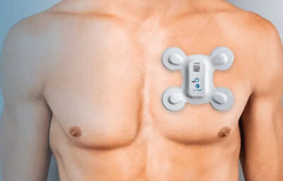 24-Hour Holter Monitoring 3